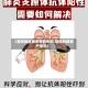 【益阳地区受疫情的影响,益阳的疫情严重吗】