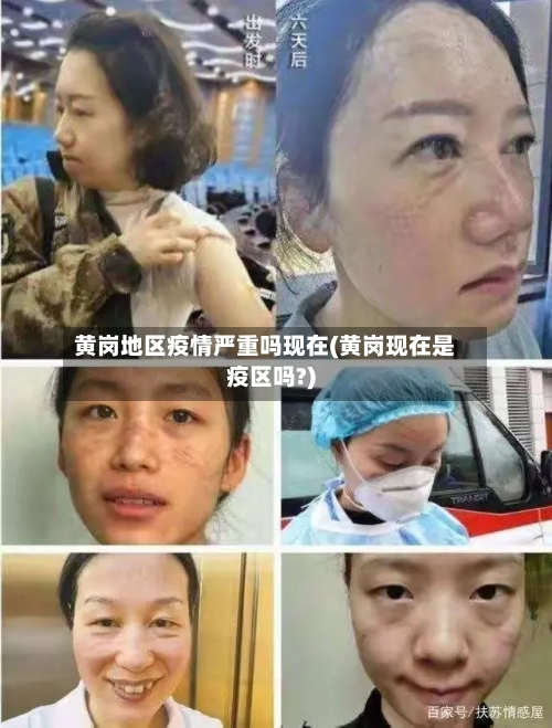 黄岗地区疫情严重吗现在(黄岗现在是疫区吗?)-第1张图片