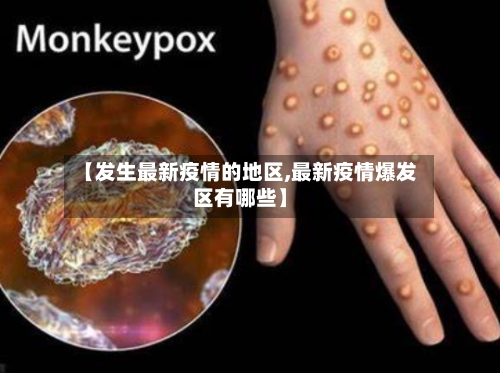 【发生最新疫情的地区,最新疫情爆发区有哪些】-第1张图片
