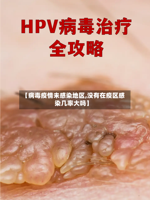 【病毒疫情未感染地区,没有在疫区感染几率大吗】-第1张图片