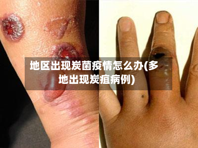 地区出现炭菌疫情怎么办(多地出现炭疽病例)-第2张图片